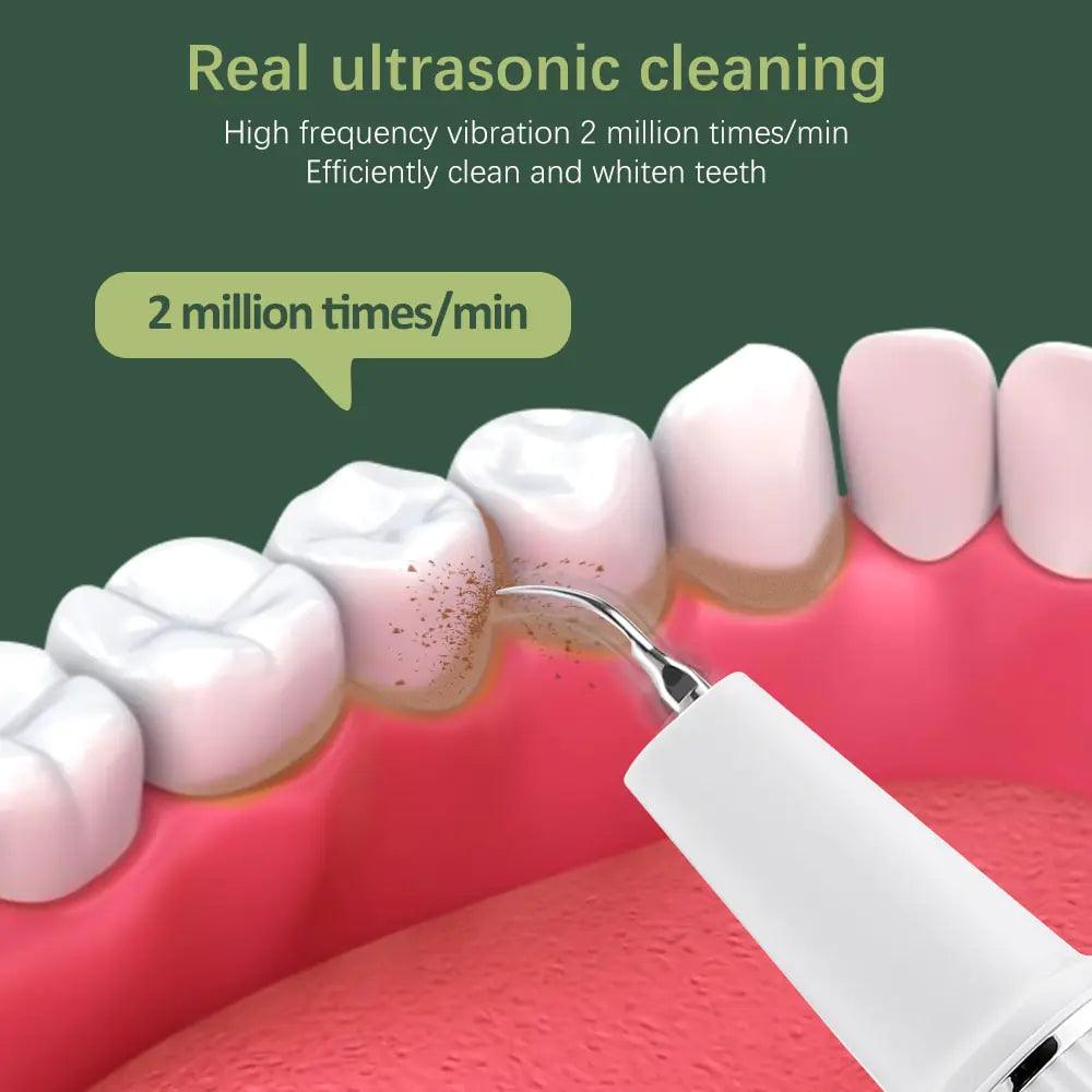 Ultrasonic Tooth Cleaner With Camera - Oral Agency